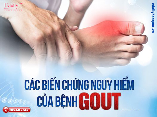 Các biến chứng nguy hiểm của bệnh gout gây ra là gì?