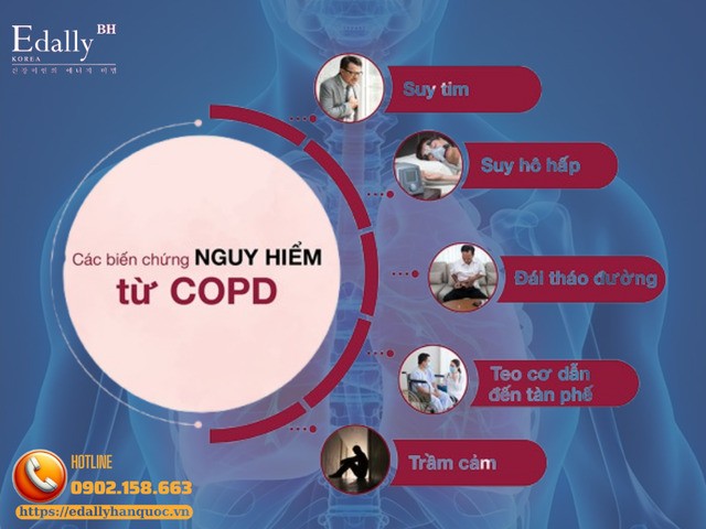 Bệnh phổi tắc nghẽn mãn tính (COPD) nguy hiểm như thế nào? Bệnh phổi tắc nghẽn mãn tính (COPD) nguy hiểm như thế nào?