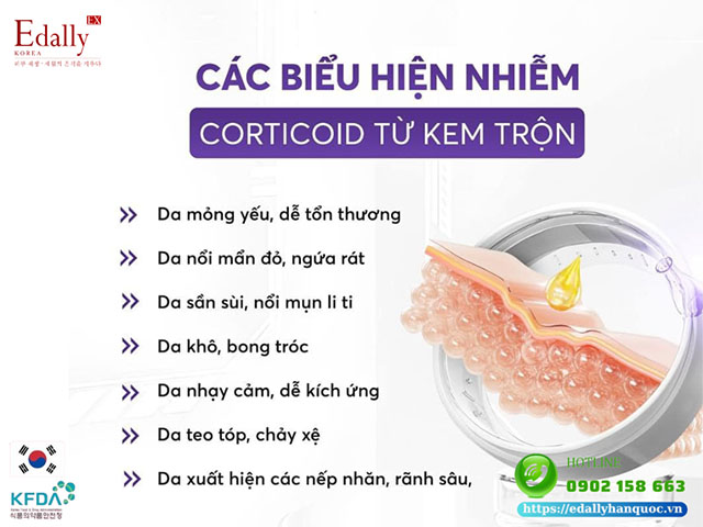 Các biểu hiện của da nhiễm Corticoid từ kem trộn và rượu thuốc