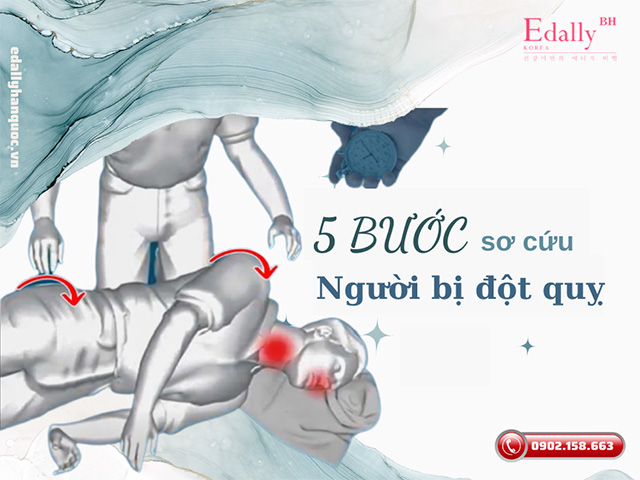 Nếu bất ngờ gặp một ai đó bị đột quỵ, bạn đã biết cách sơ cứu bệnh nhân bị đột quỵ phù hợp?