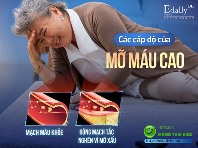 Bệnh mỡ máu cao được chia làm mấy cấp độ?