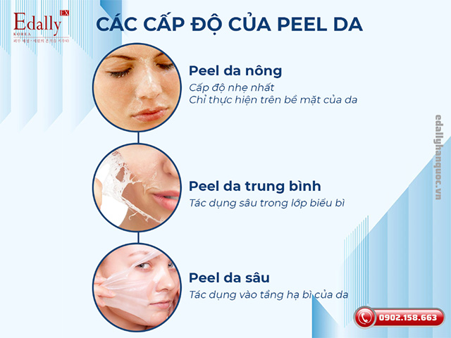 Các cấp độ Peel da