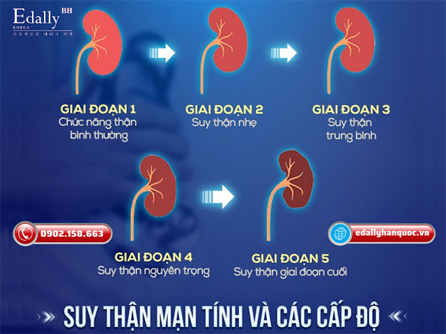 Các cấp độ của bệnh suy thận mạn tính