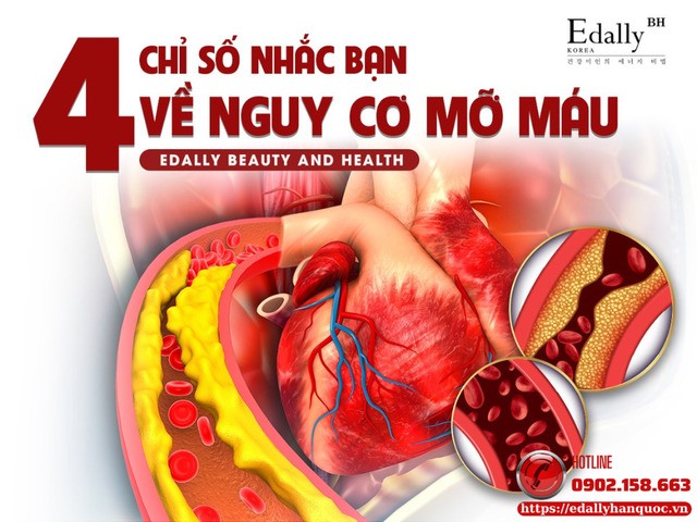 Các chỉ số mỡ máu quyết định sức khỏe tim mạch và cách để tối ưu hóa