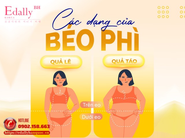 Các dạng của thừa cân béo phì