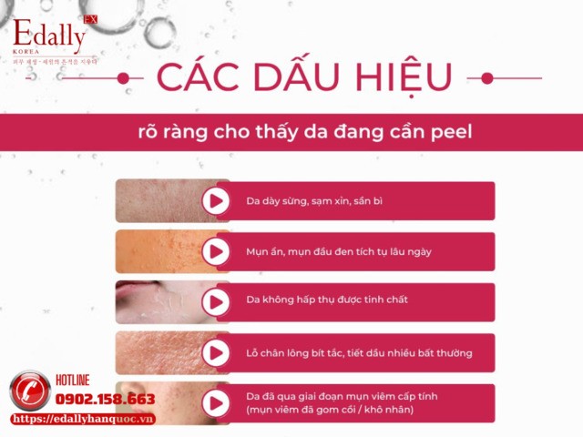 Các dấu hiệu rõ ràng cho thấy da bạn đang cần phải peel da