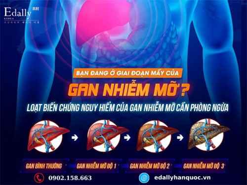 Các Giai Đoạn Của Bệnh Gan Nhiễm Mỡ