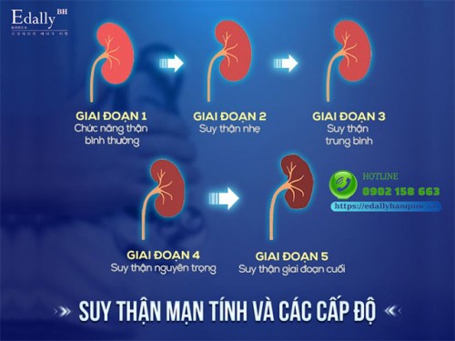 5 Giai Đoạn Suy Thận Mạn Tính & Những Điều Cần Biết