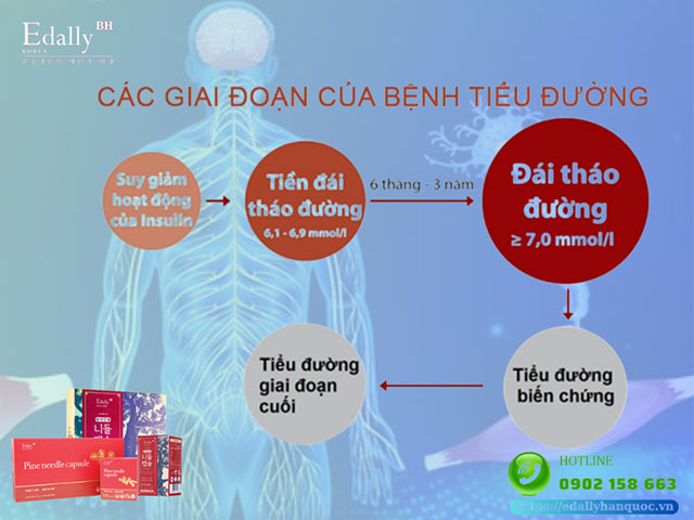 Các giai đoạn của bệnh tiểu đường mà bạn cần biết