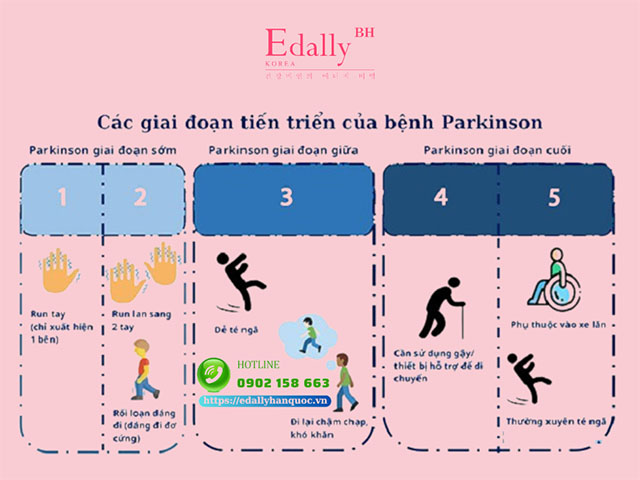 Các giai đoạn tiến triển của bệnh Parkinson