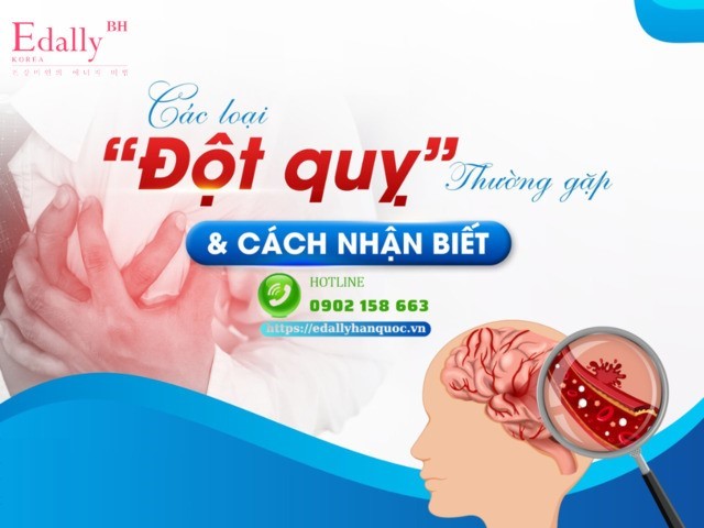 Các loại đột quỵ thường gặp và cách nhận biết ️để cứu chữa kịp thời