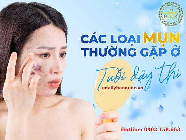 Một số loại mụn thường gặp ở tuổi dậy thì