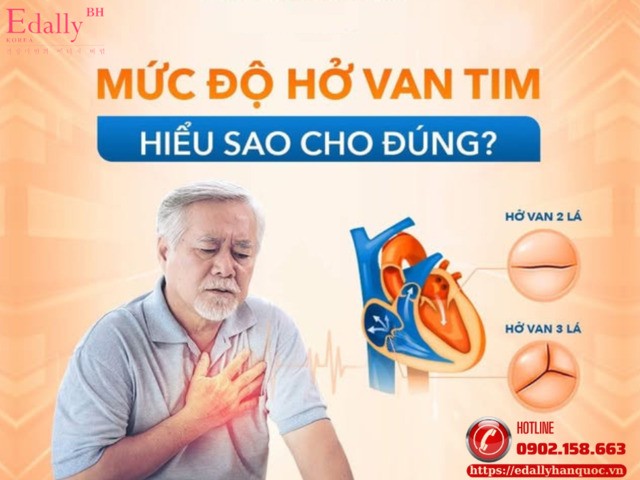 Mức độ hở van tim - Hiểu sao cho đúng?
