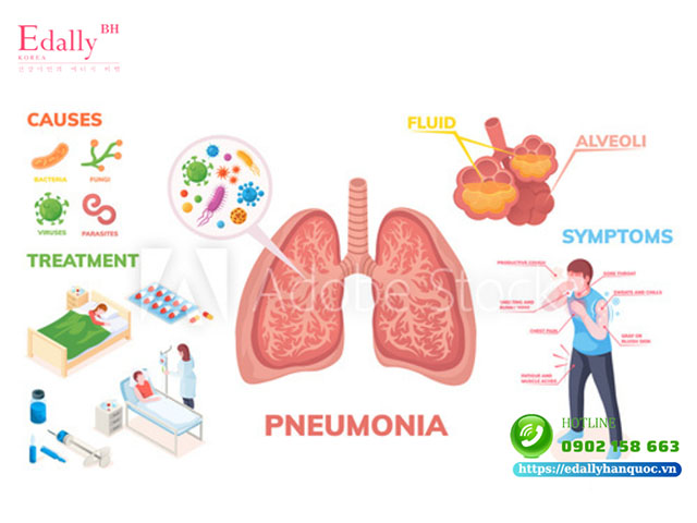 Các nguồn gây bệnh viêm phổi