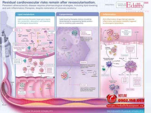 Các nguy cơ tim mạch tồn dư sau tái thông mạch vành