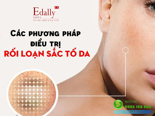 Các phương pháp điều trị rối loạn sắc tố da