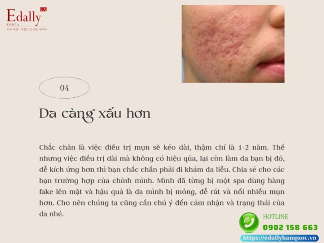 Spa kém chất lượng, không uy tín càng điều trị da thì da càng xấu hơn