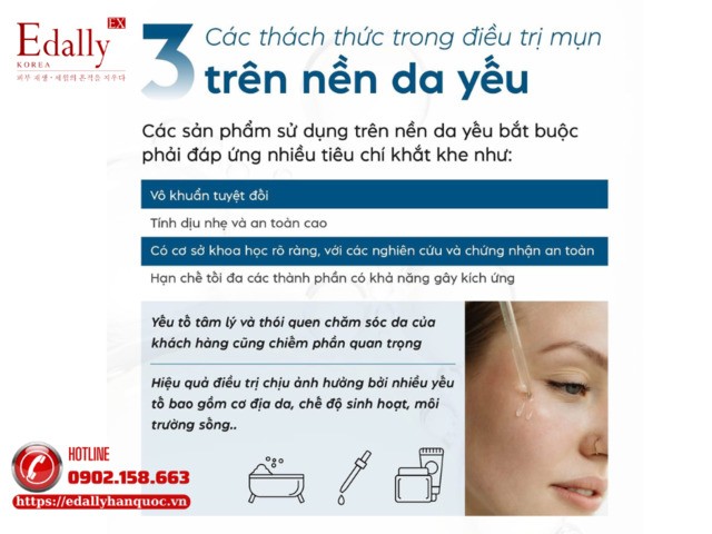 Những thách thức trong điều trị mụn trên nền da yếu
