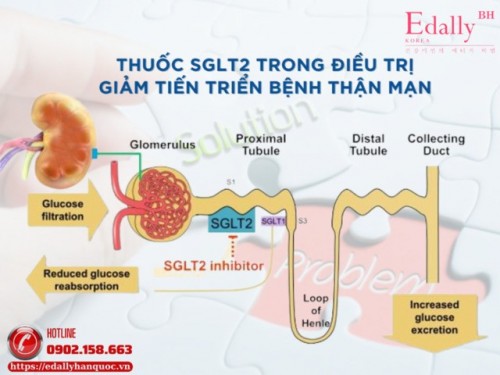 Các Thuốc Nhóm SGLT2i Có An Toàn Cho Thận Ở Bệnh Nhân Suy Thận Mạn (CKD) Không?