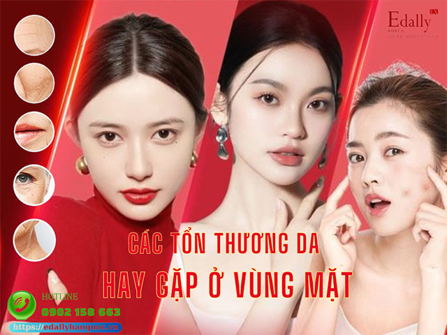 Các tổn thương da hay gặp ở vùng mặt