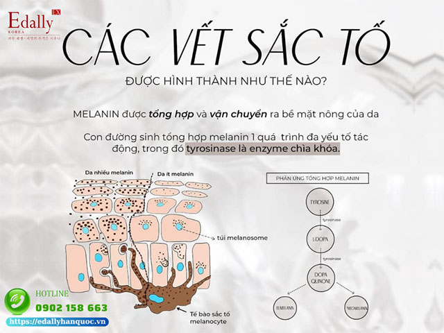 Sự hình thành các vết tăng sắc tố trên da