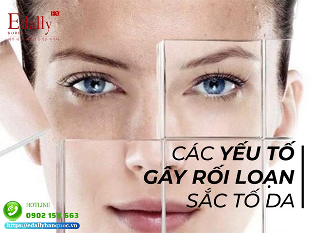 Các yếu tố nguy cơ gây rối loạn sắc tố da