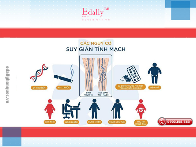 Các yếu tố nguy cơ gây suy giãn tĩnh mạch