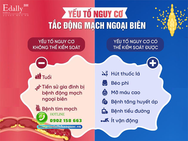 Các yếu tố nguy cơ gây tắc động mạch ngoại biên