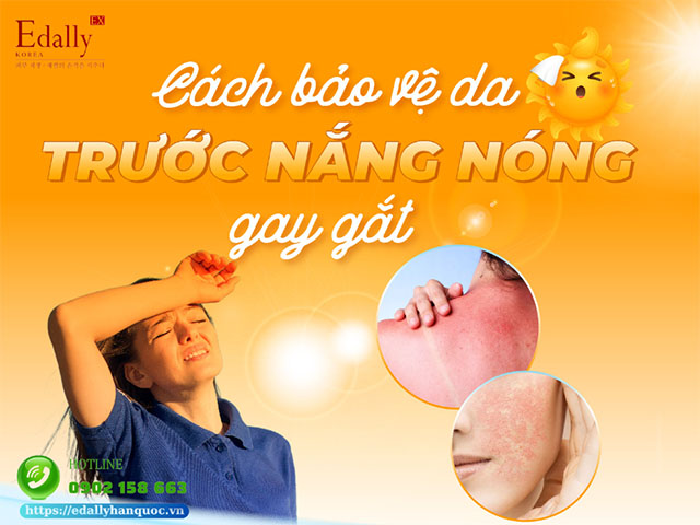Bí Quyết Bảo Vệ Làn Da Khi Tiếp Xúc Với Nắng Hè Gay Gắt