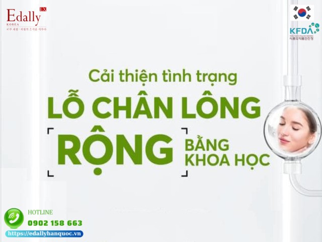 Cách cải thiện tình trạng lỗ chân lông rộng bằng khoa học