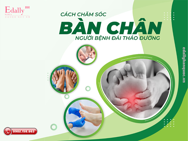 Cách chăm sóc mất cảm giác ở bàn chân ở người bệnh Đái tháo đường như thế nào?