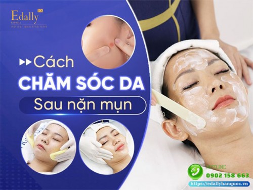 Chăm Sóc Da Sau Nặn Mụn Sao Cho Nhanh Lành?