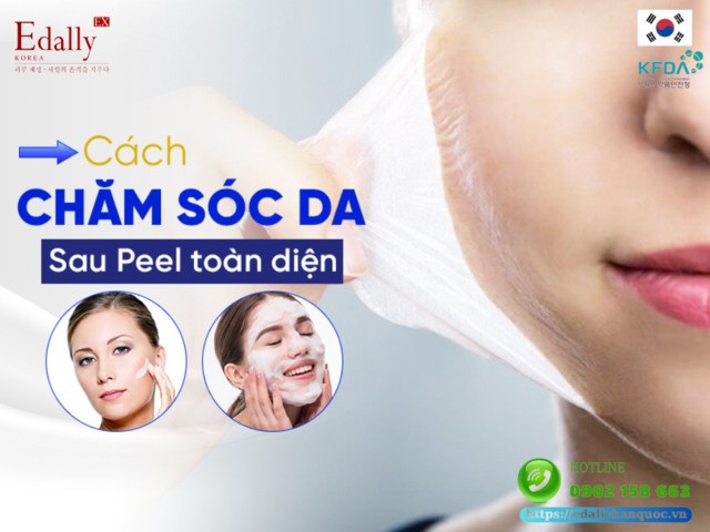 Cách chăm sóc da sau Peel da toàn diện, hiệu quả, an toàn tại nhà