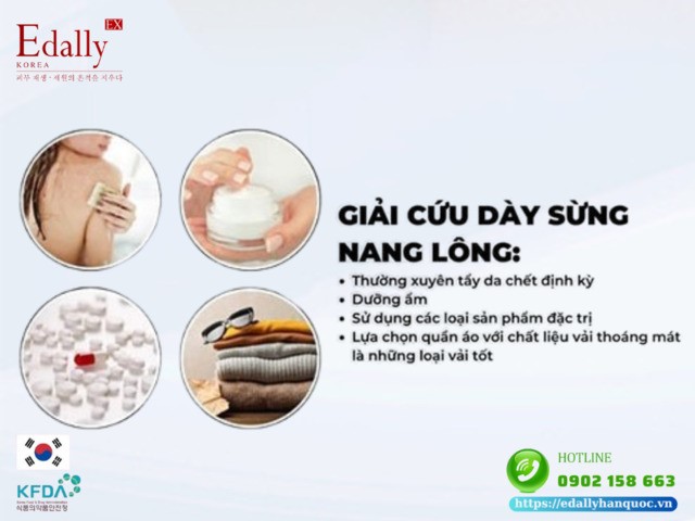 Hướng dẫn cách chăm sóc da dày sừng nang lông tại nhà hiệu quả