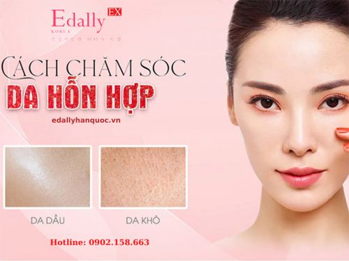 Da Hỗn Hợp Là Gì? Phân Loại Và Cách Chăm Sóc Làn Da Hỗn Hợp