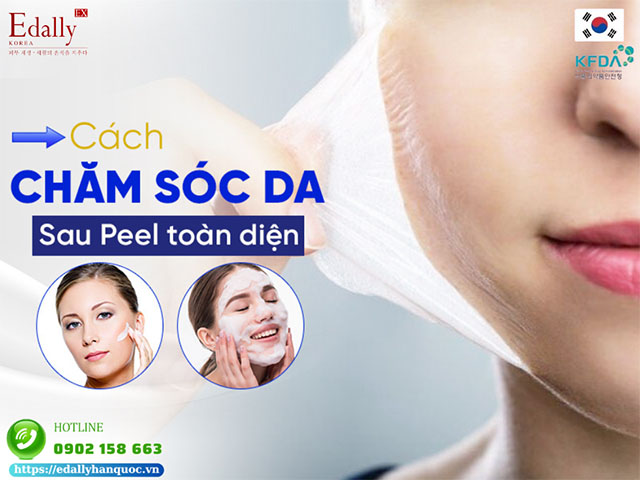 Cách chăm sóc và phục hồi da nhạy cảm sau peel da một cách toàn diện