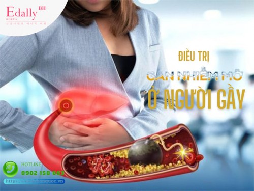 Cách Chẩn Đoán Và Điều Trị Bệnh Gan Nhiễm Mỡ Ở Người Gầy