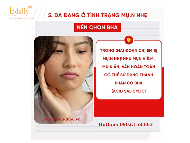 Hướng dẫn cách lựa chọn serum cho làn da đang bị mụn nhẹ