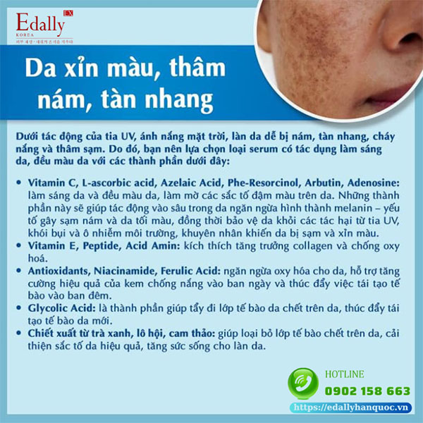 Cách lựa chọn serum cho tình trạng da xỉn màu, thâm nám, tàn nhang