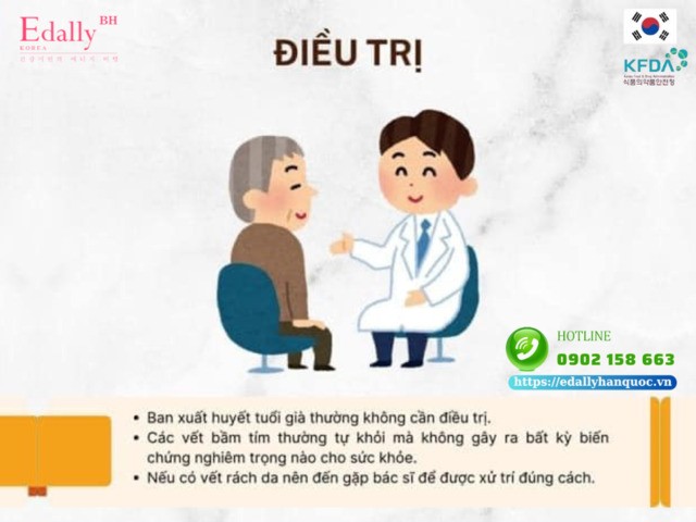 Cách điều trị ban xuất huyết ở người già như thế nào?