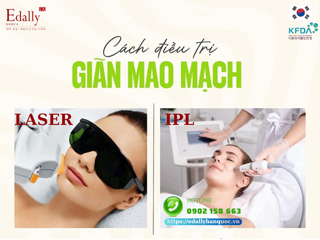 Cách điều trị da mặt bị giãn mao mạch như thế nào?