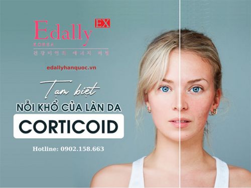 Làm Sao Để Biết Da Bạn Đang Bị Nhiễm Corticoide?