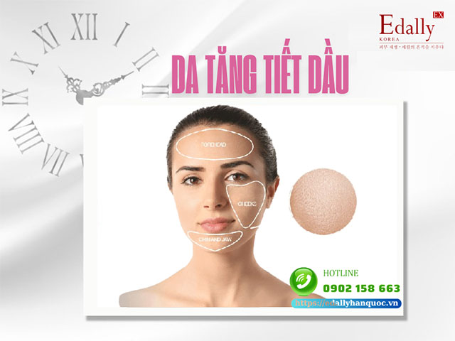 Các Phương Pháp Điều Trị Cho Da Tăng Tiết Dầu An Toàn Và Hiệu Quả 