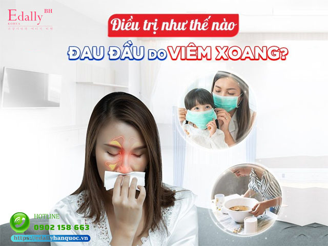 Cách điều trị đau đầu do viêm xoang như thế nào?