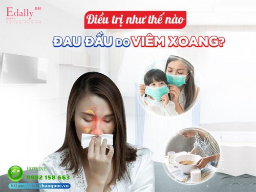 Đau Đầu Do Viêm Xoang Điều Trị Như Thế Nào?