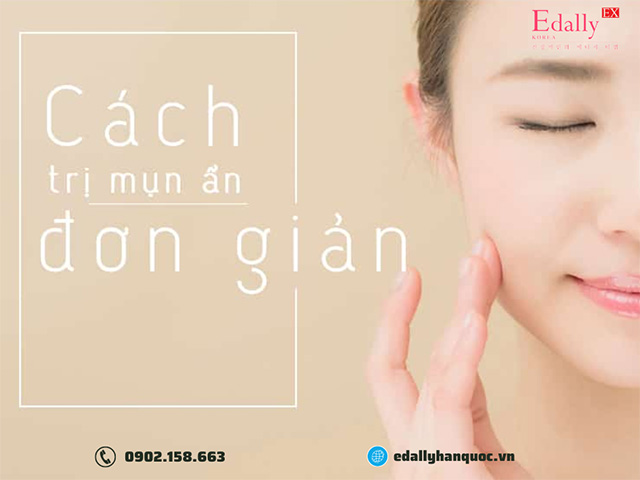 Cách điều trị mụn ẩn dưới da đơn giản