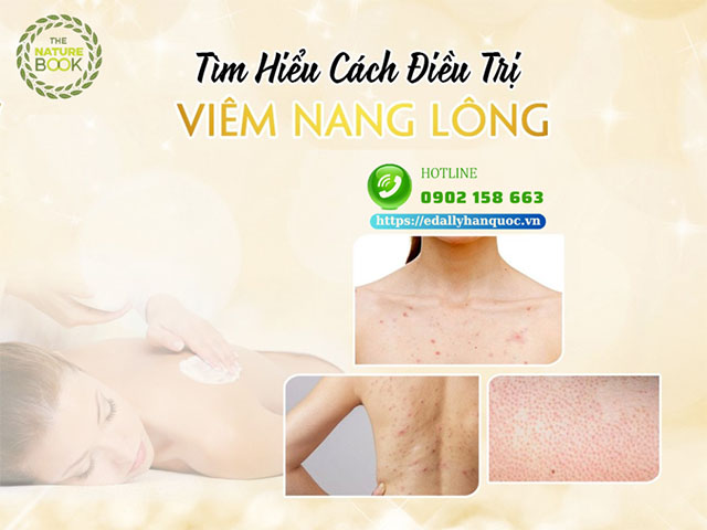 Viêm nang lông và cách điều trị hiệu quả tại nhà