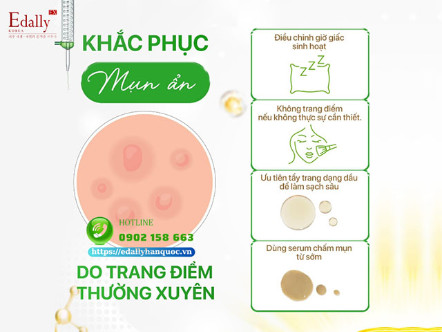 Cách khắc phục mụn ẩn do trang điểm thường xuyên