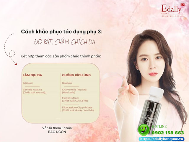 Cách khắc phục triệt để tác dụng phụ 3 của Retinol