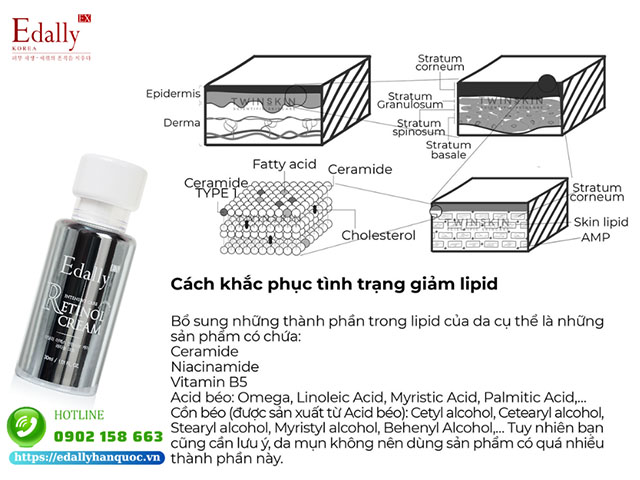 Cách khắc phục tình trạng lipid trong da do tác dụng phụ khi dùng Retinol